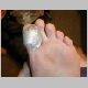 48-Big toe (duct-taped) and pinky toe covered with blisters (I got off easy).jpg